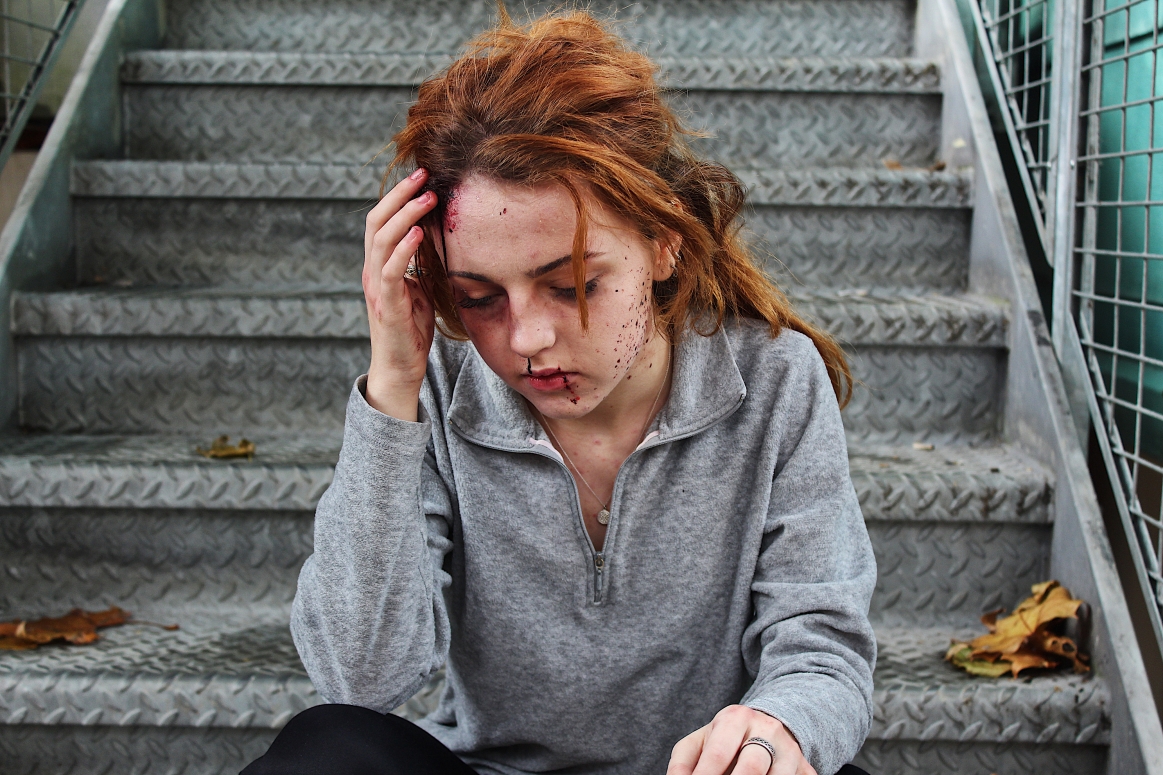 SFX Casualty makeup - hostage scenario